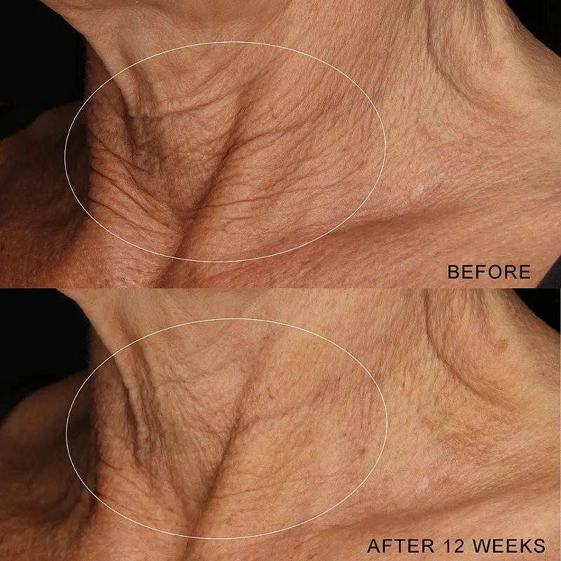 Dermalogica Neck Fit Contour System
