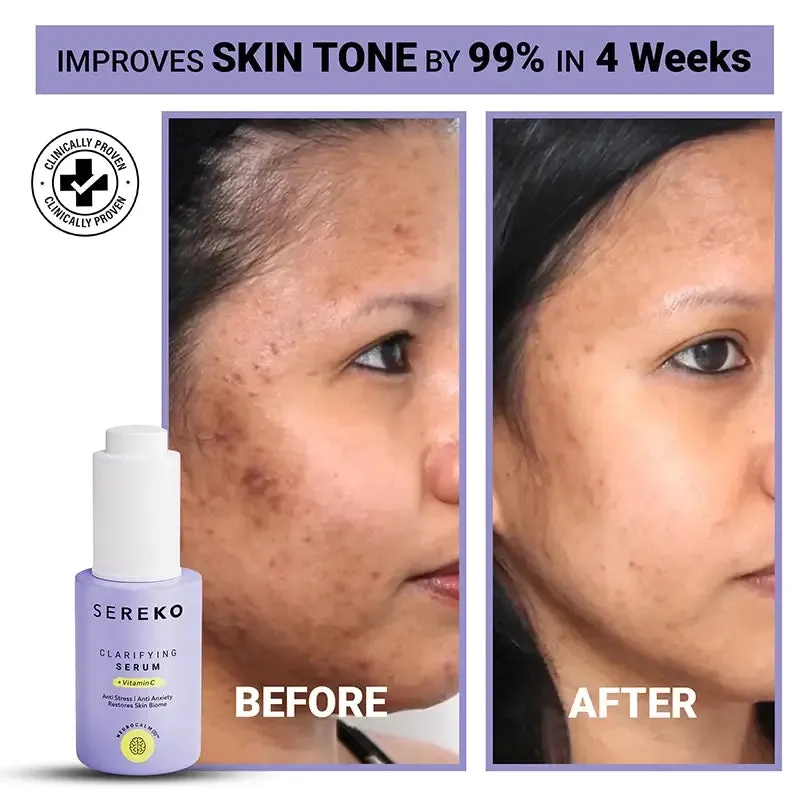 Vitamin C Clarifying Face Serum